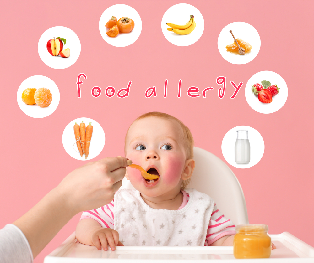 A baby with a rash on their cheeks is being fed with a spoon. Surrounding the baby are images of common allergenic foods, including apples, bananas, honey, strawberries, milk, carrots, oranges, and peanuts. The text reads food allergy.
